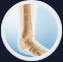 Ankle Fracture