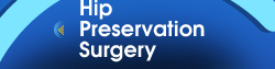 Hip Preservation Surgery - Hip & Fracture Institute Nashville